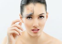 Comment cacher l'acné et les décolorations