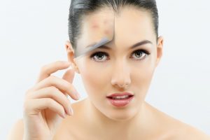 Comment cacher l'acné et les décolorations
